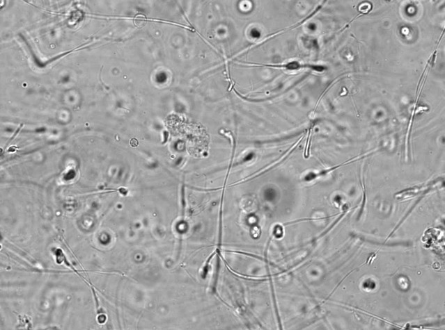 Figures And Data In Centriolar Satellites Expedite Mother Centriole