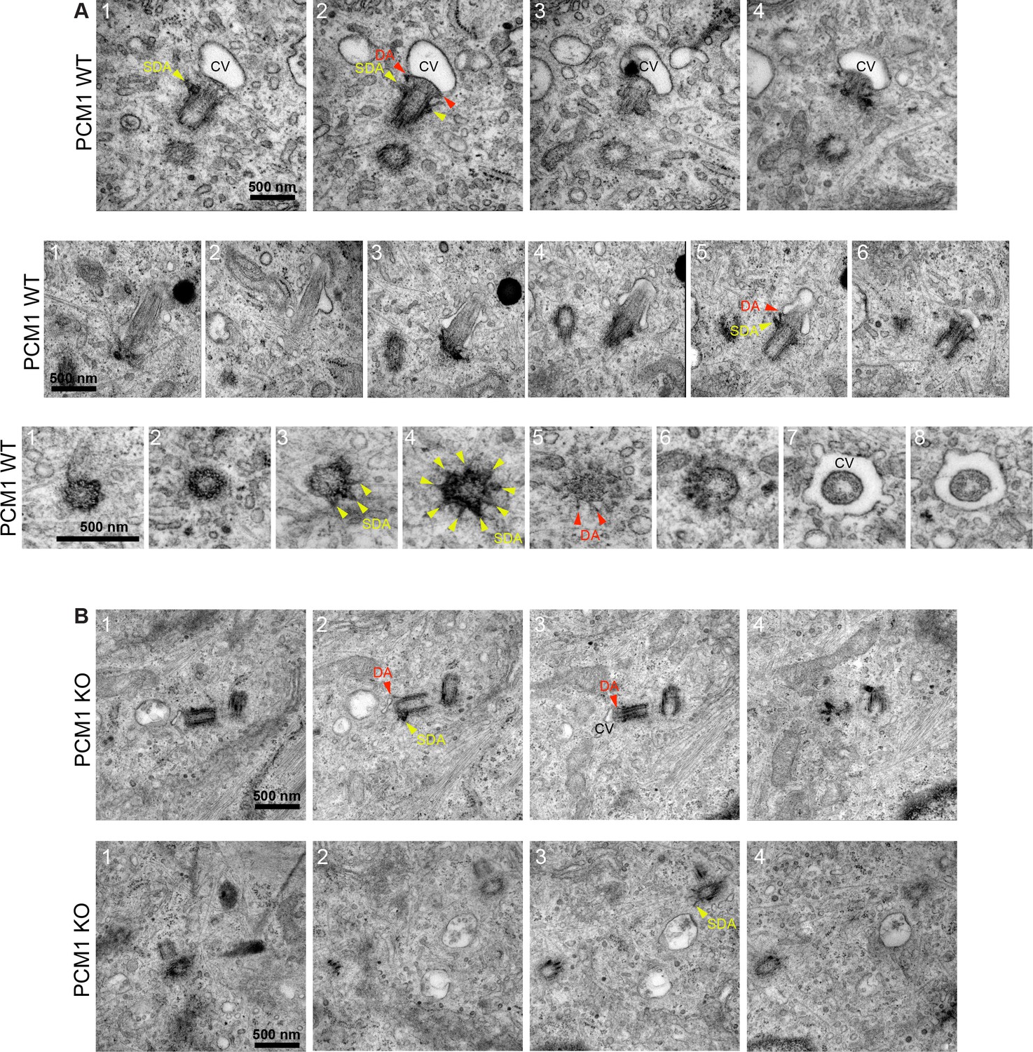 Figures And Data In Centriolar Satellites Expedite Mother Centriole