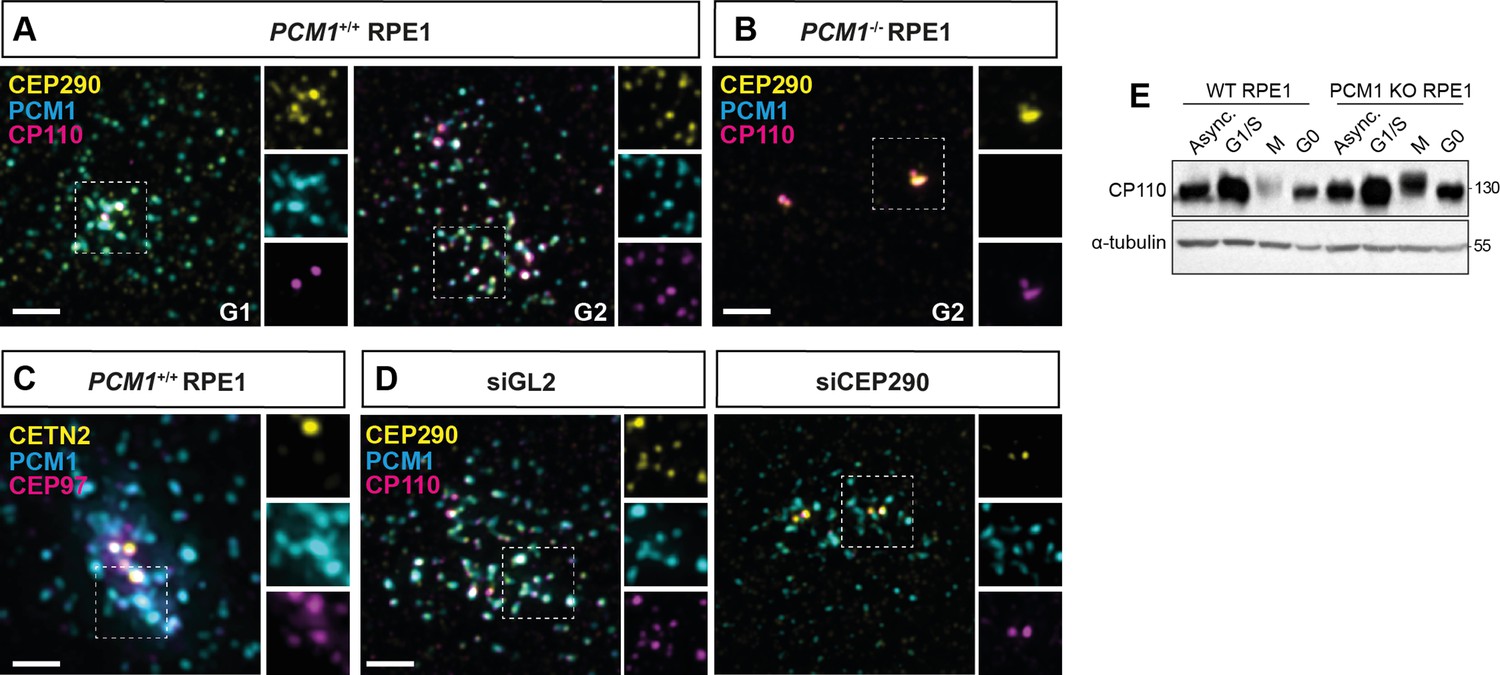 Figures And Data In Centriolar Satellites Expedite Mother Centriole