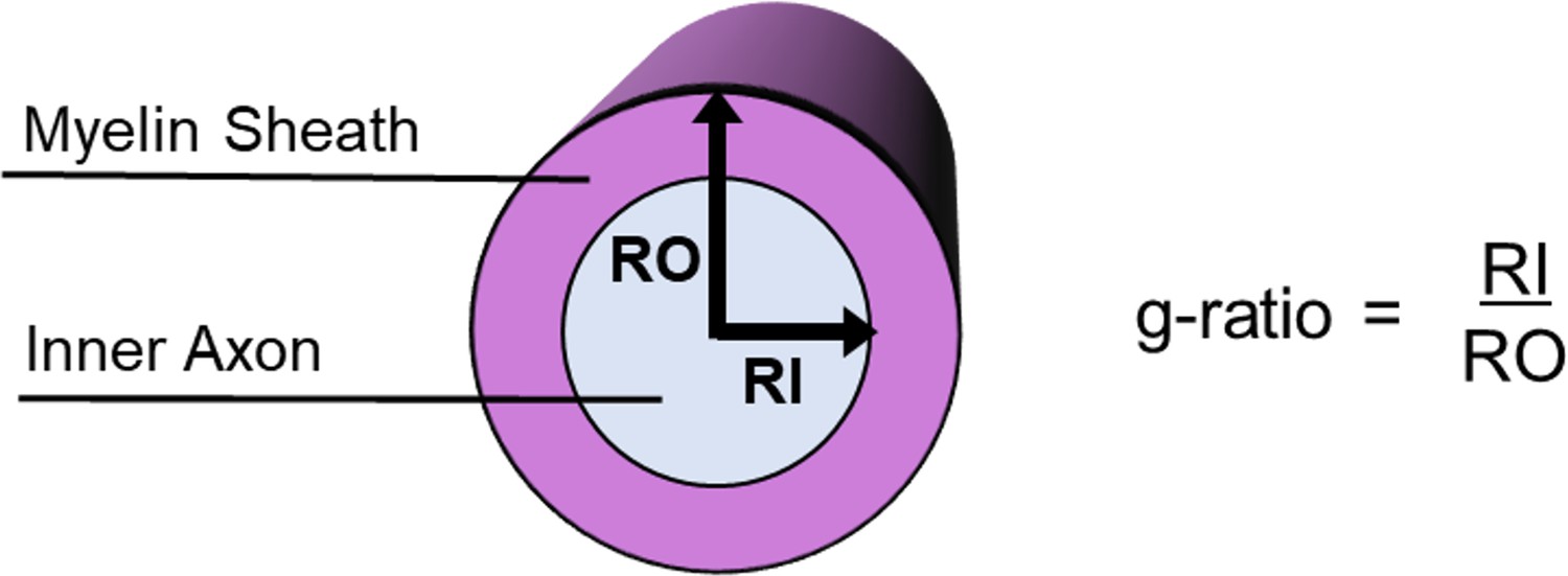 Conduction Velocity Along A Key White Matter Tract Is Associated With