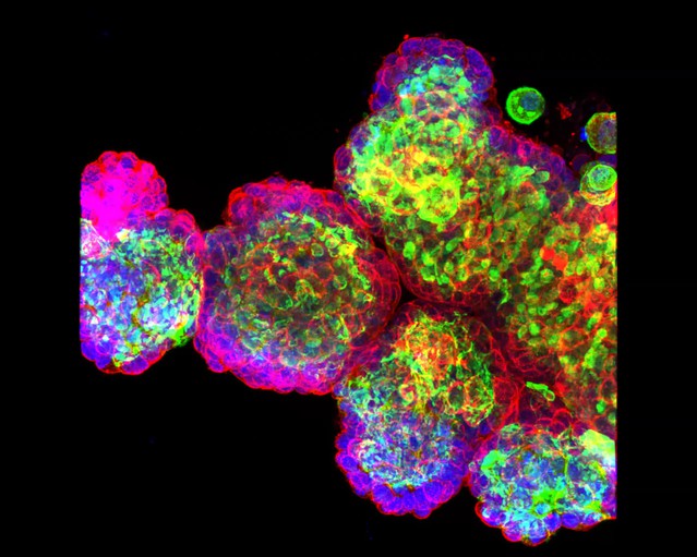 Figures and data in Innate immune signaling in trophoblast and decidua ...