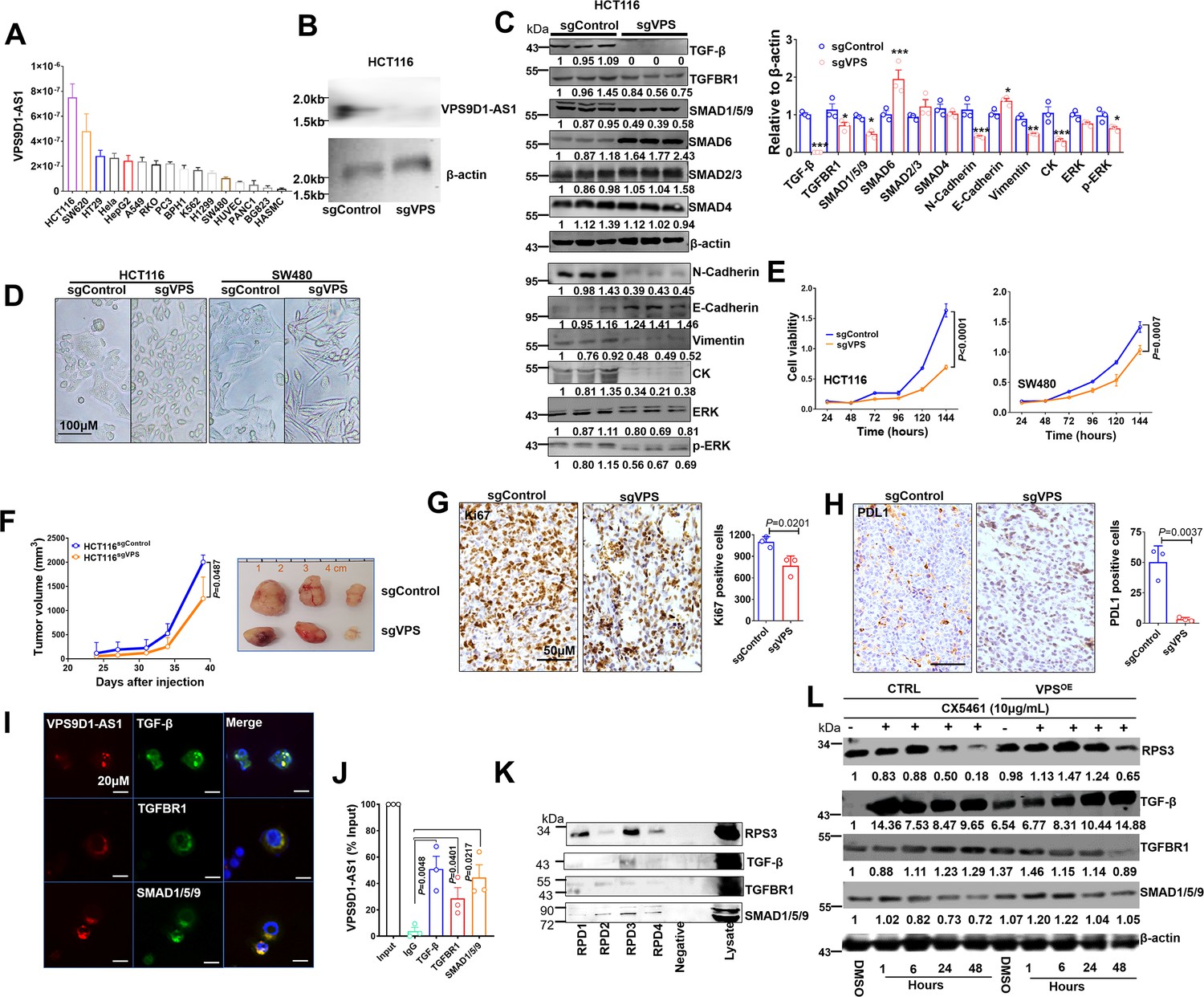 VPS9D1-AS1 overexpression amplifies intratumoral TGF-β VPS9D1-AS1 overexpression amplifies intratumoral TGF-β
