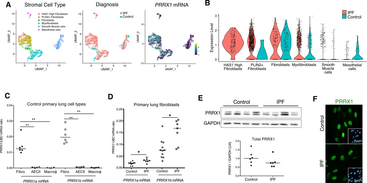 Identification Of Paired-related Homeobox Protein 1 As A Key ...