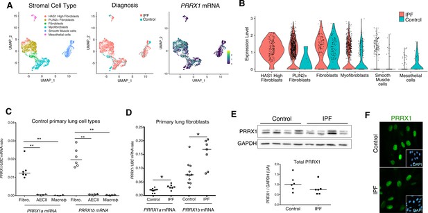 Identification Of Paired-related Homeobox Protein 1 As A Key ...