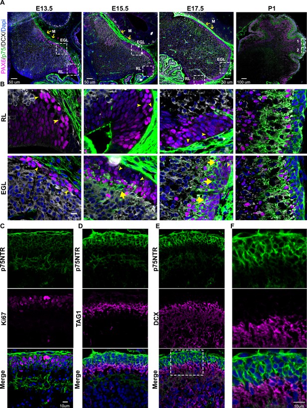 p75NTR prevents the onset of cerebellar granule cell migration via RhoA ...