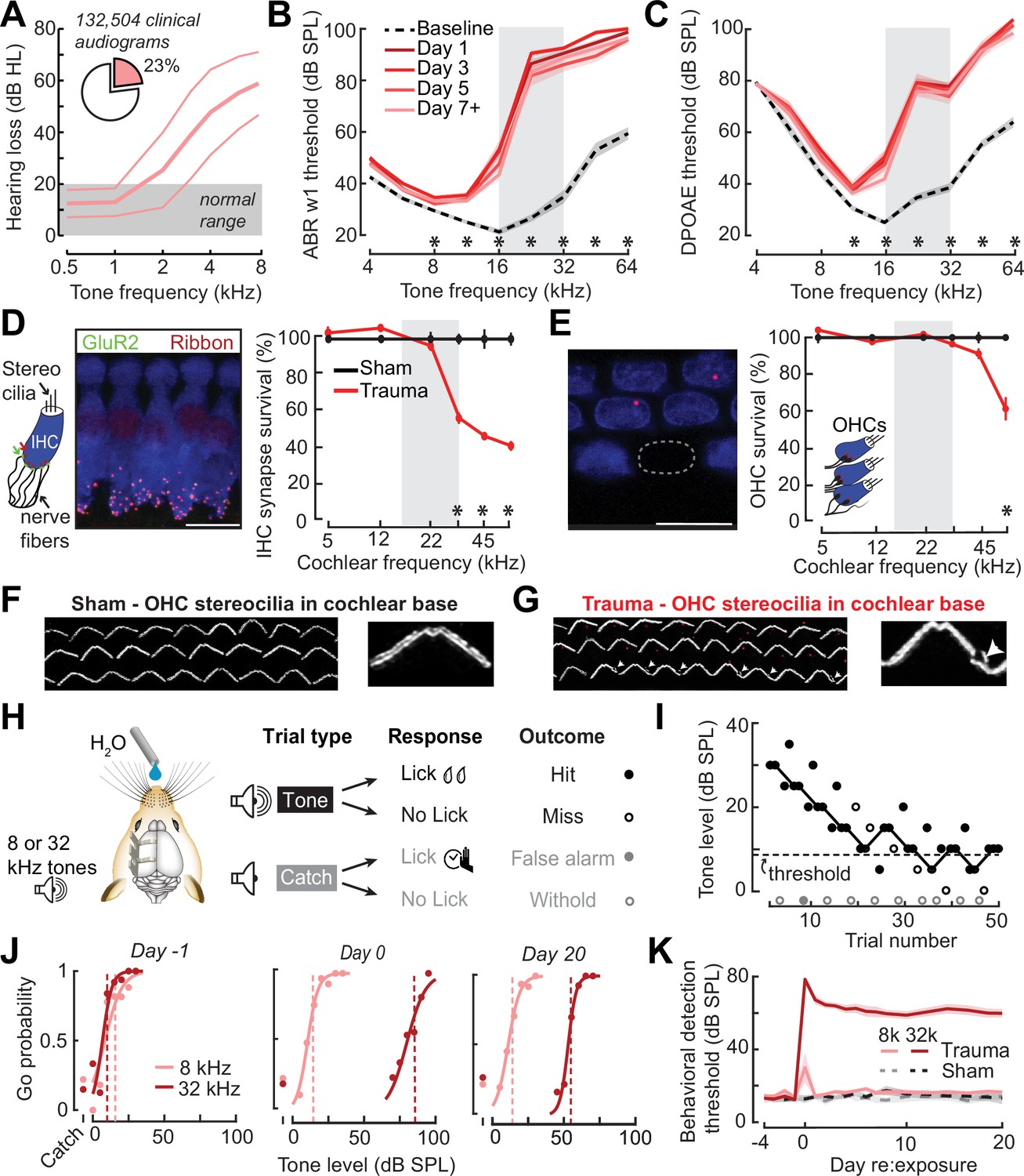 Neural signatures of auditory hypersensitivity following acoustic