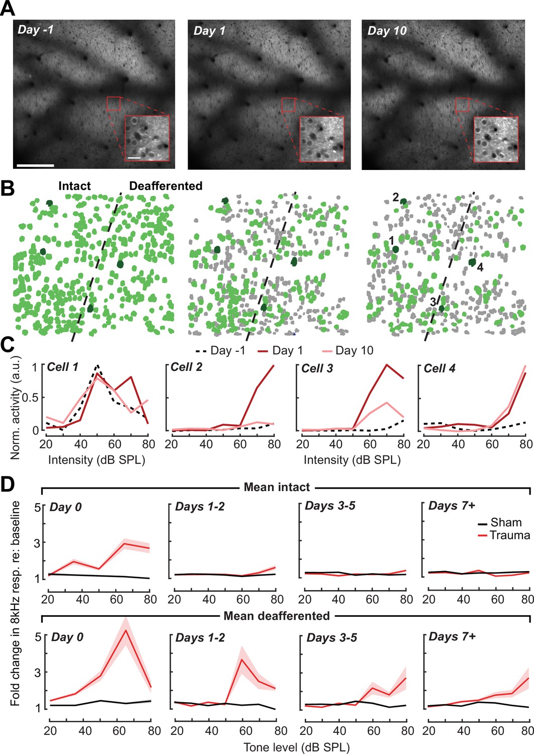 Neural signatures of auditory hypersensitivity following acoustic ...