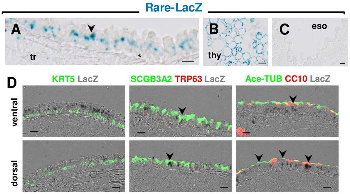 Figures and data in Airway basal cells show regionally distinct ...