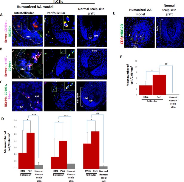 Involvement Of ILC1-like Innate Lymphocytes In Human Autoimmunity ...