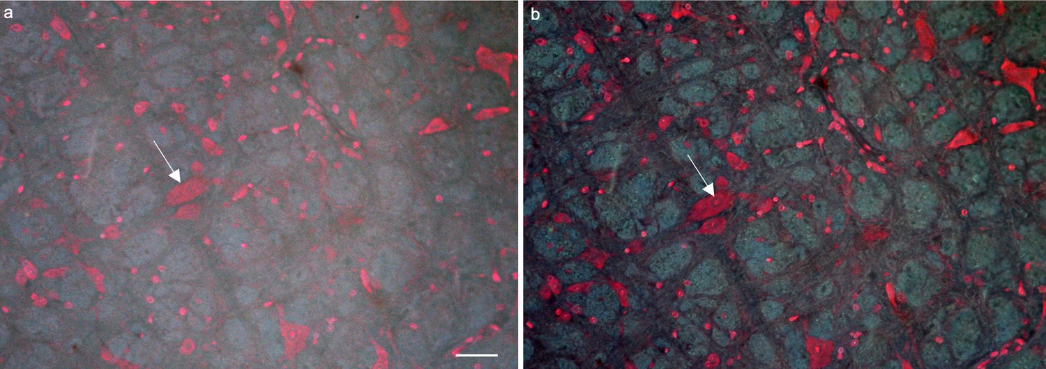 Figures and data in Translational rapid ultraviolet-excited sectioning ...