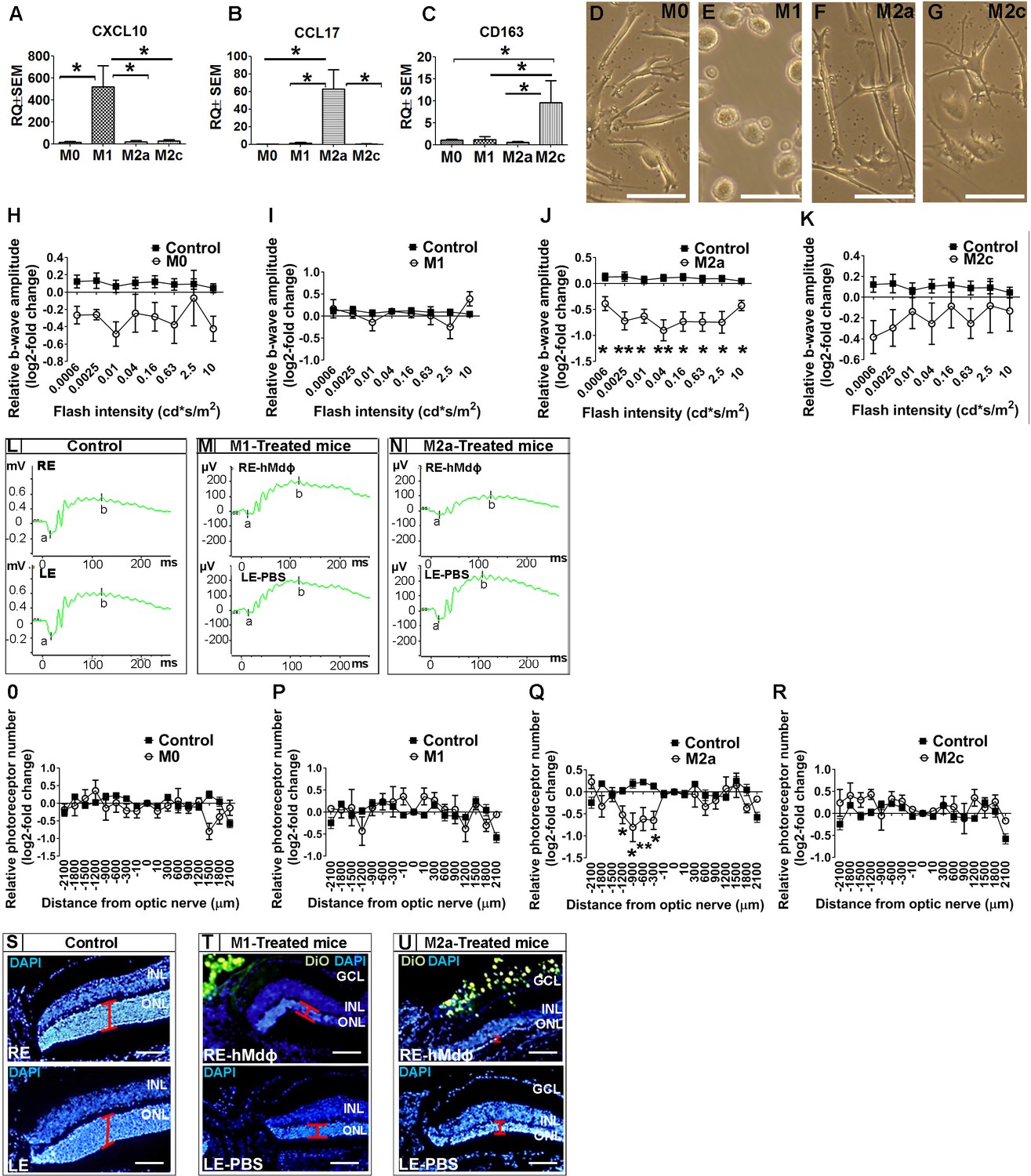 Figures And Data In Ccr1 Mediates Müller Cell Activation And