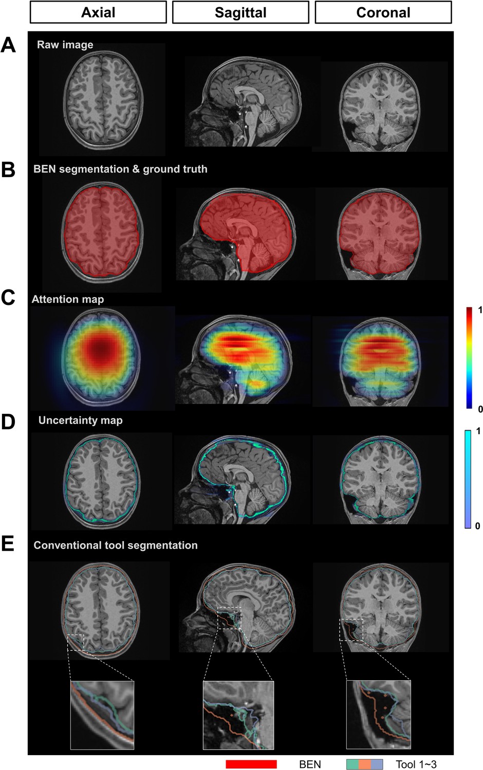 Figures and data in A generalizable brain extraction net (BEN) for ...