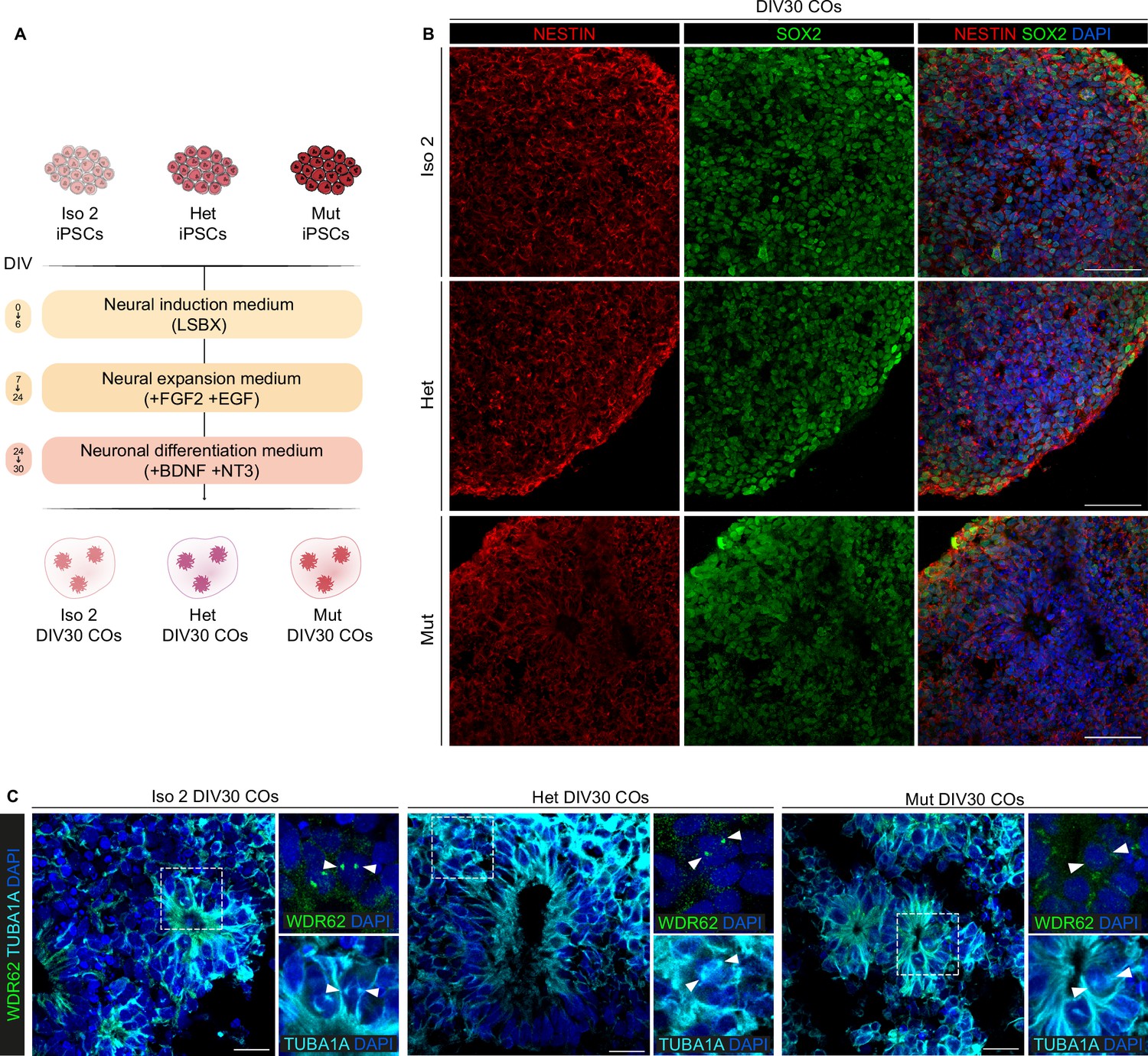 Figures And Data In Microcephaly-associated Protein WDR62 Shuttles From ...