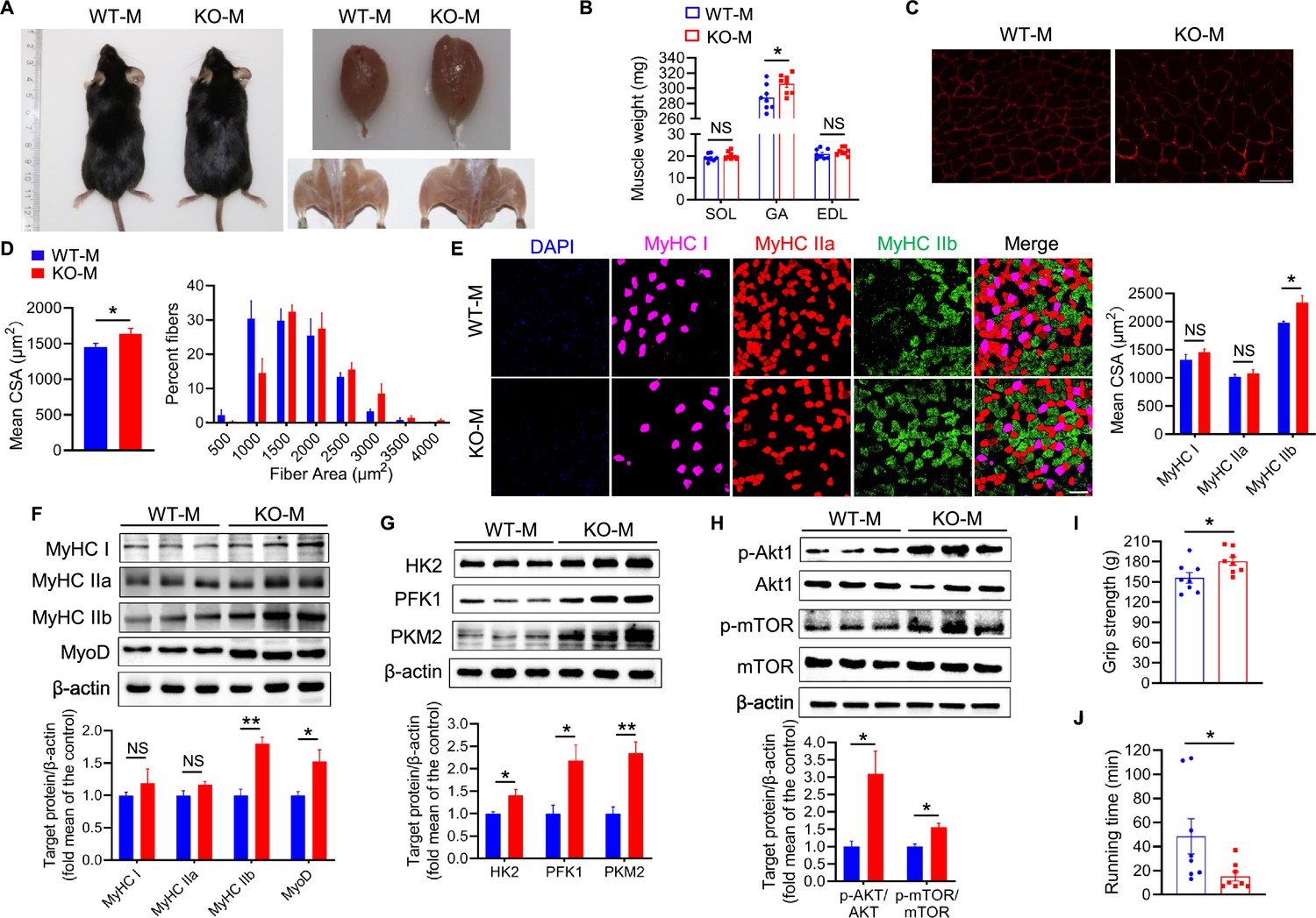 Fecal transplant from myostatin deletion pigs positively impacts