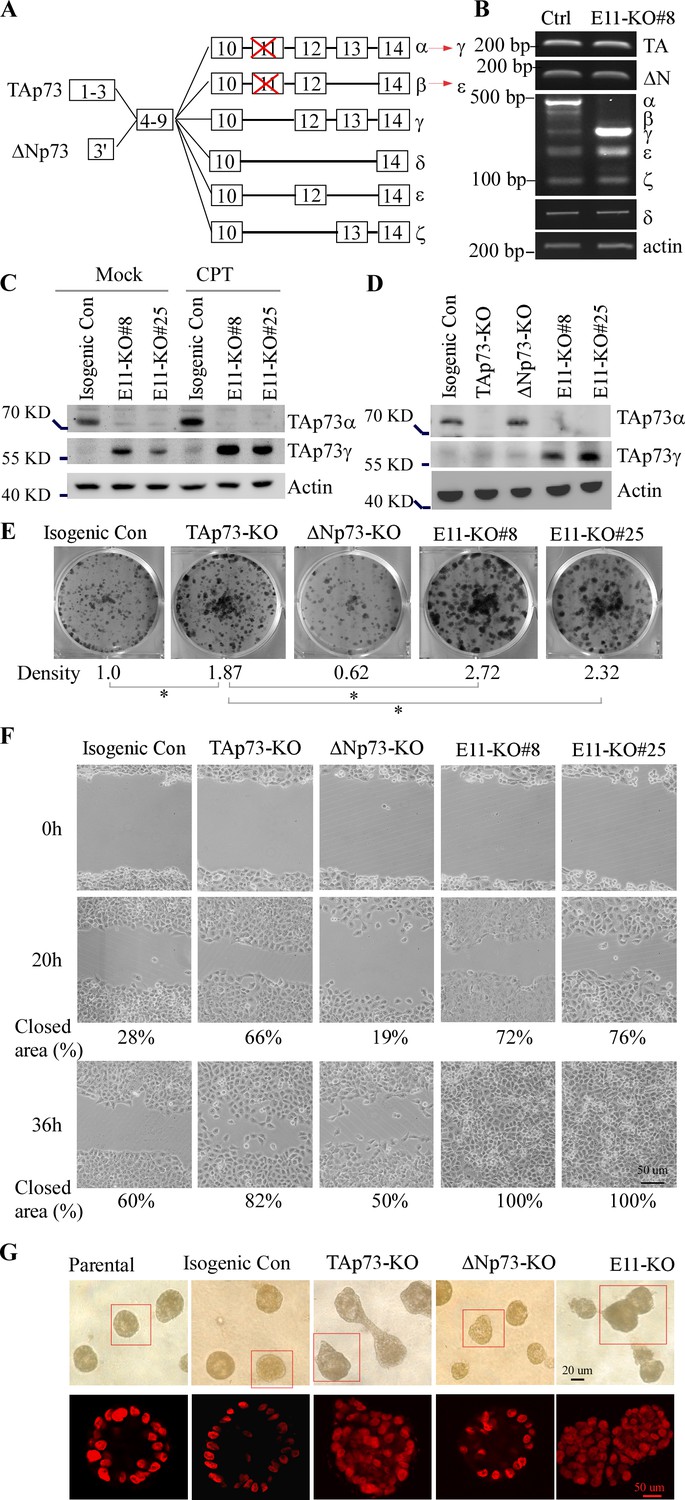 Isoform Specific Disruption Of The Tp73 Gene Reveals A Critical Role