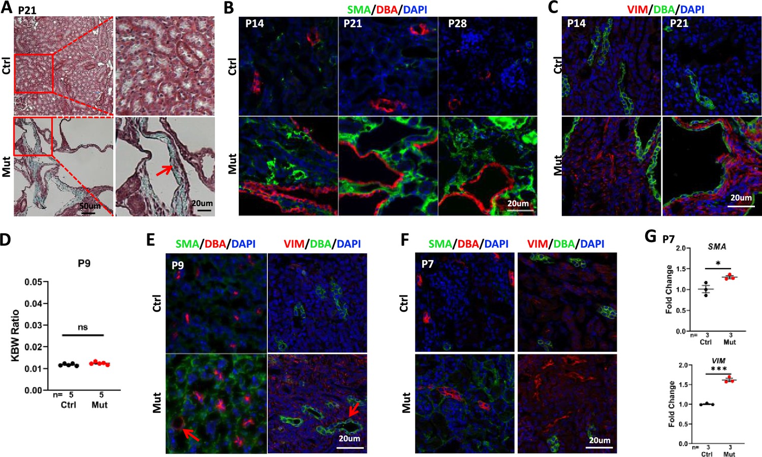 Inactivation of Invs/Nphp2 in renal epithelial cells drives infantile ...