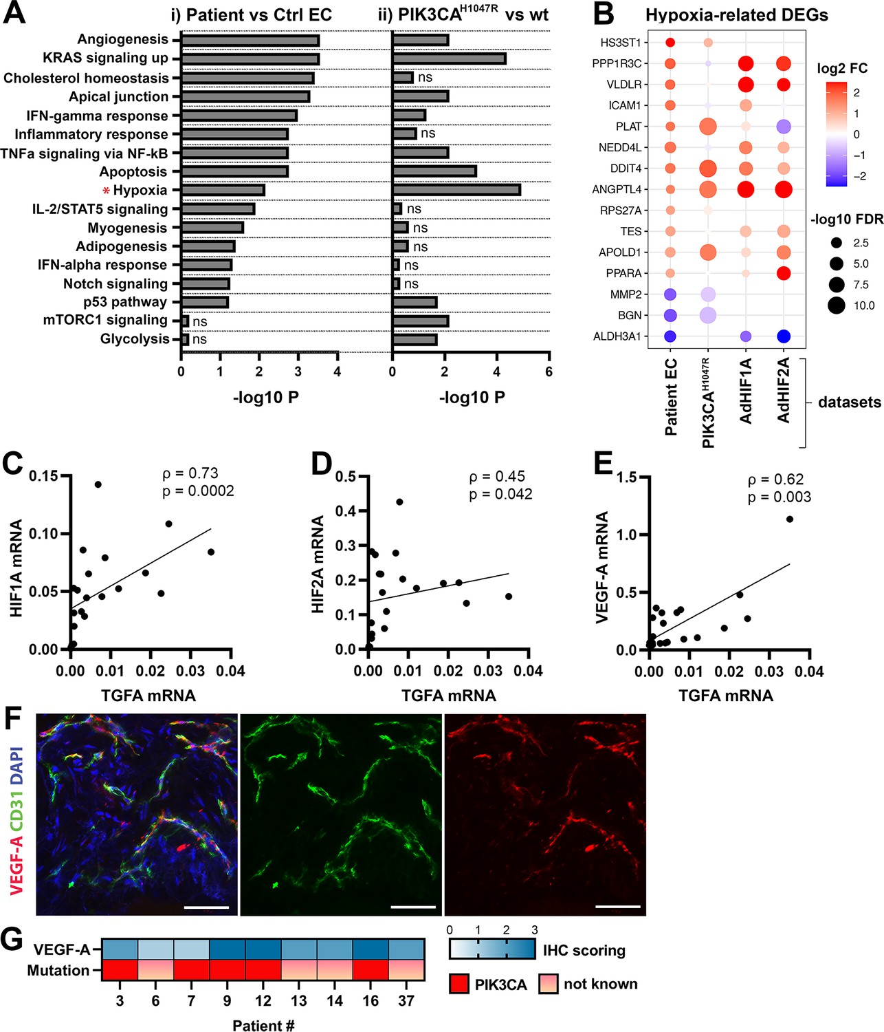 ErbB signaling is a potential therapeutic target for vascular lesions ...