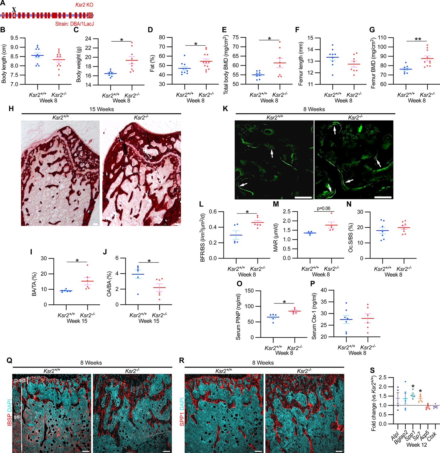 Contrasting effects of Ksr2, an obesity gene, on trabecular bone volume and  bone marrow adiposity | eLife