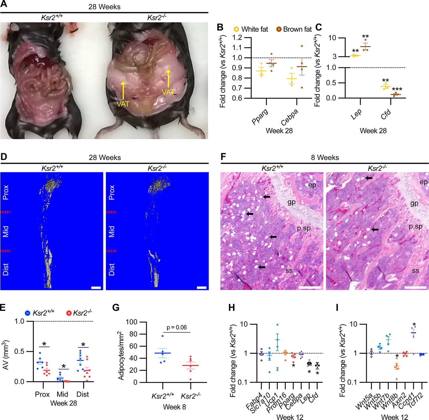 Contrasting effects of Ksr2, an obesity gene, on trabecular bone volume and  bone marrow adiposity | eLife