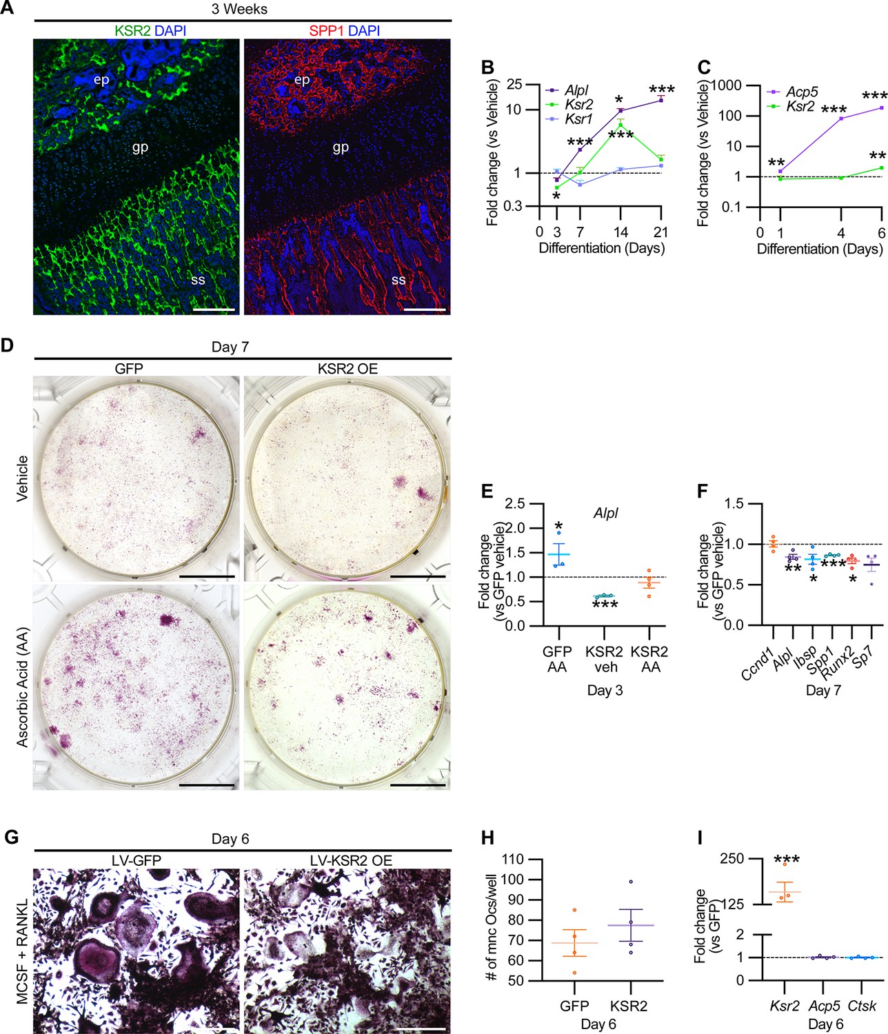 Contrasting effects of Ksr2, an obesity gene, on trabecular bone volume and  bone marrow adiposity | eLife