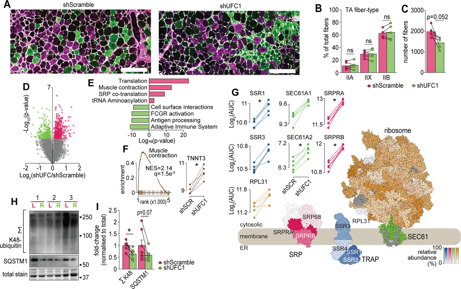 Proteome-wide systems genetics identifies UFMylation as a regulator of  skeletal muscle function