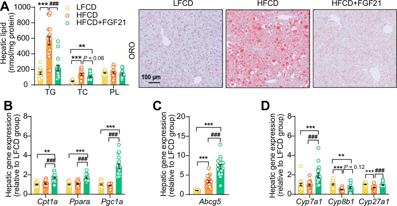 FGF21 Protects Against Hepatic Lipotoxicity And Macrophage Activation