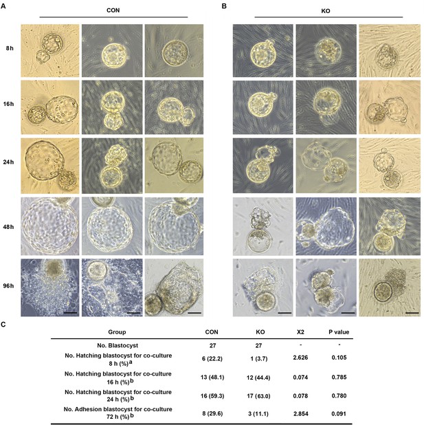 Gαq-PKD/PKCμ signal regulating the nuclear export of HDAC5 to induce ...