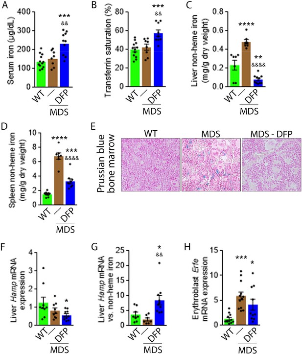 Iron chelation improves ineffective erythropoiesis and iron overload in