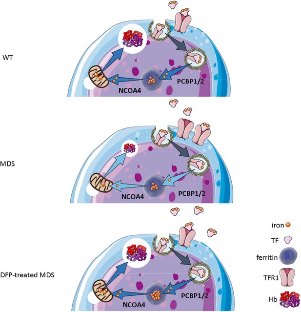 Iron chelation improves ineffective erythropoiesis and iron overload in
