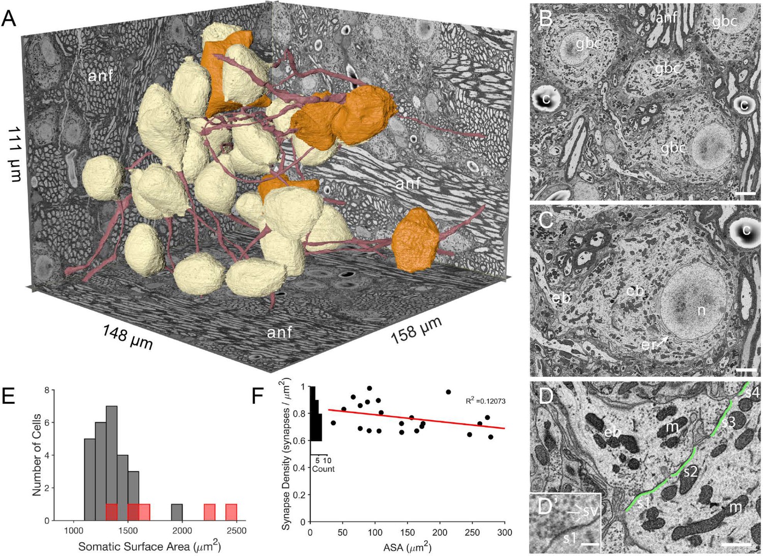 A high magnification image of synapse obtained by electron microscopy