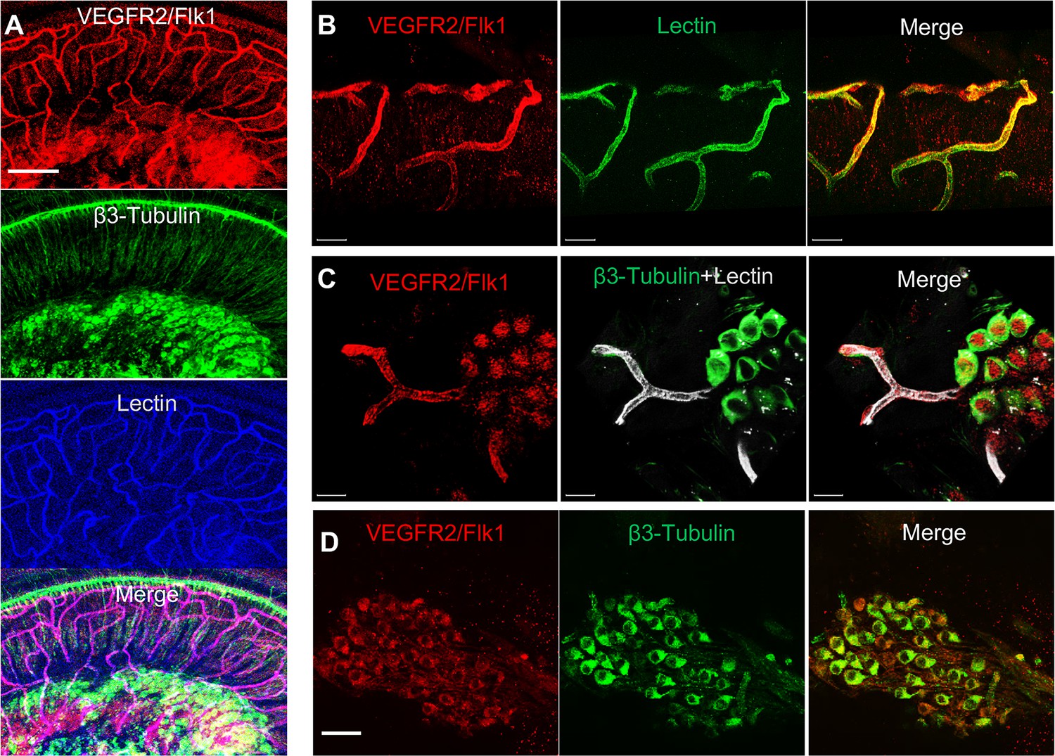 Pericytes Control Vascular Stability And Auditory Spiral Ganglion