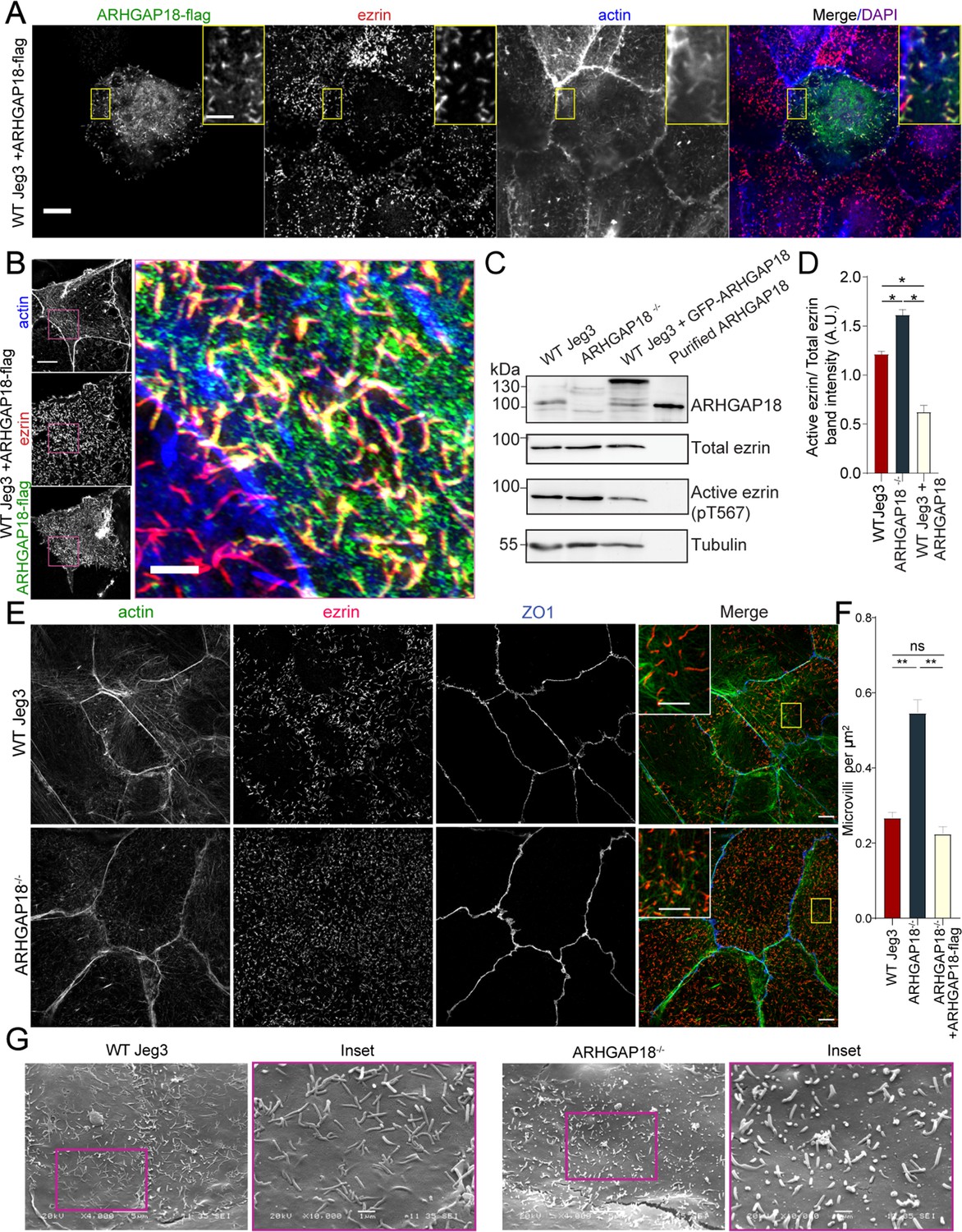 ARHGAP18-ezrin functions as an autoregulatory module for RhoA in