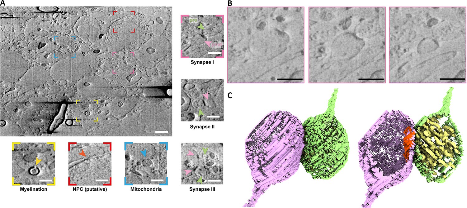 Cryo Plasma FIB SEM Volume Imaging Of Biological Specimens ELife