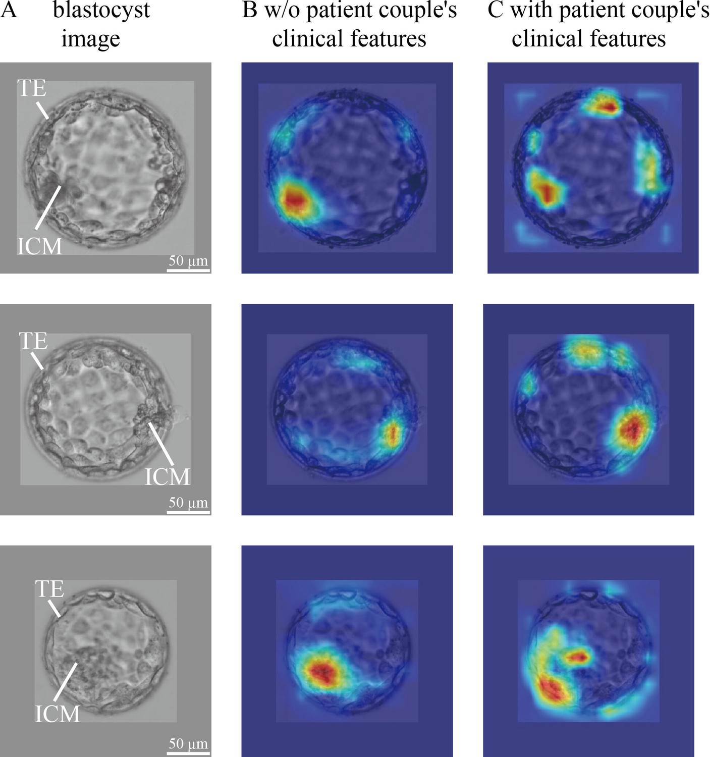 Development And Evaluation Of A Live Birth Prediction Model For ...