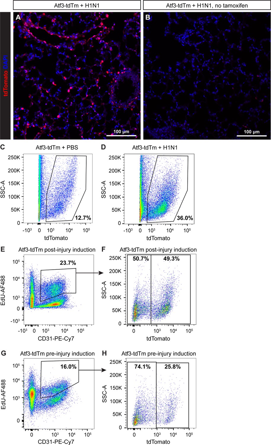 Figures and data in Atf3 defines a population of pulmonary endothelial ...