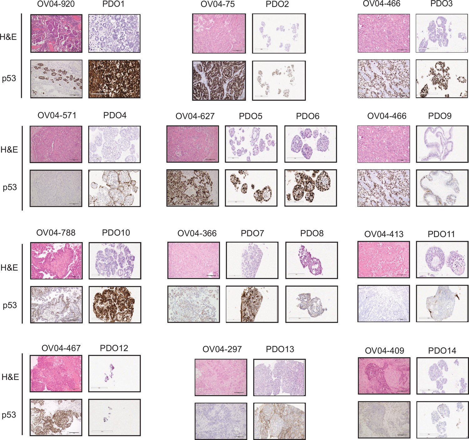 figures-and-data-in-high-grade-serous-ovarian-carcinoma-organoids-as