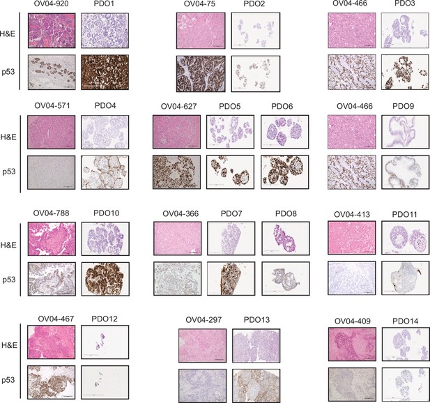 Figures And Data In High-grade Serous Ovarian Carcinoma Organoids As ...