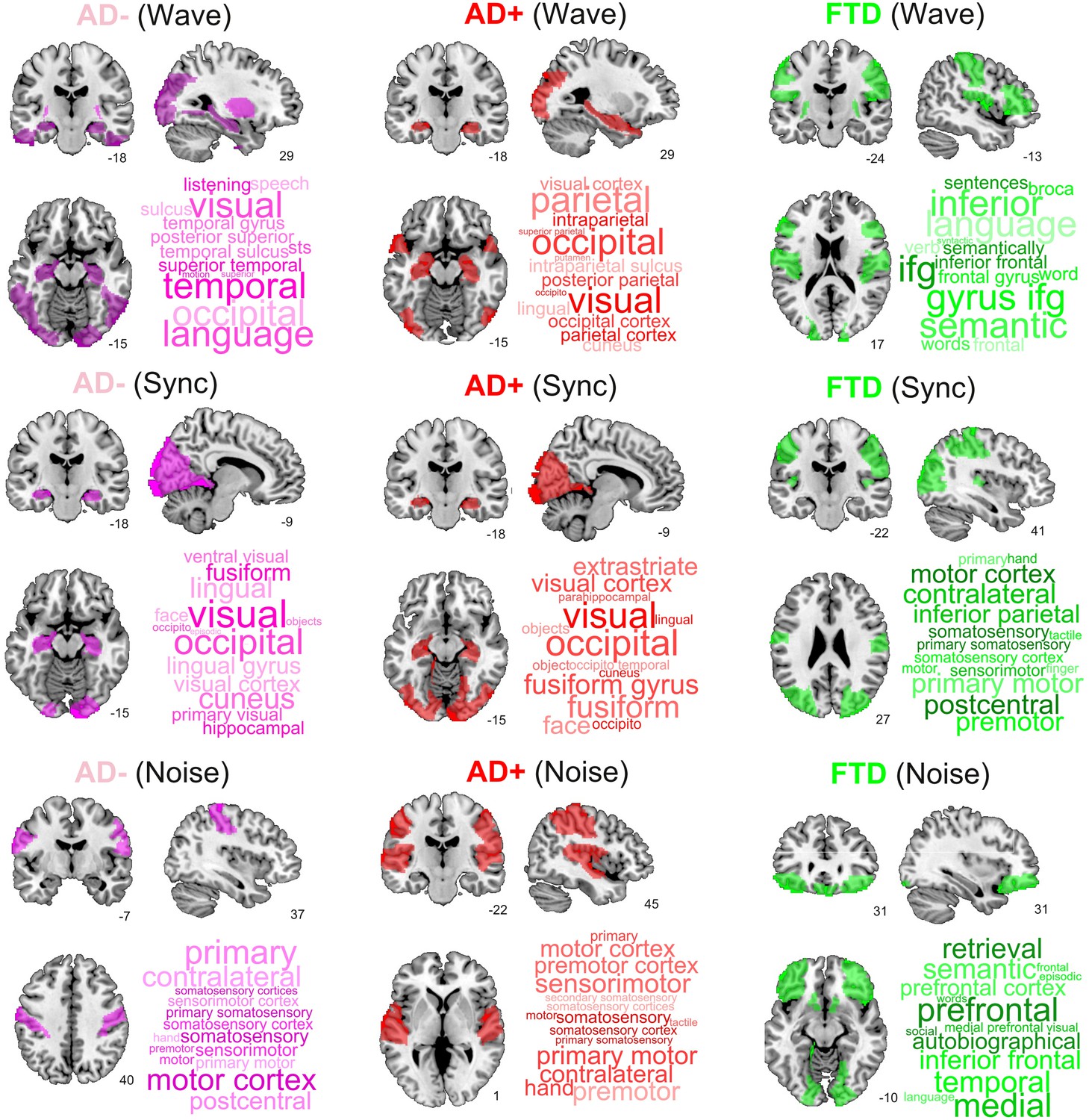 Improving the study of brain-behavior relationships by revisiting basic  assumptions: Trends in Cognitive Sciences