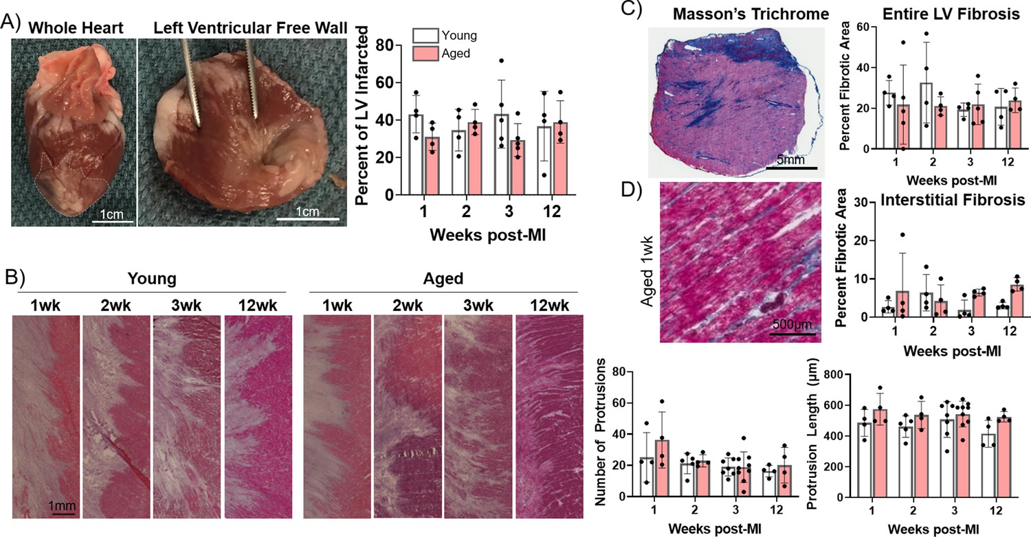 Myofibroblast senescence promotes arrhythmogenic remodeling in the aged