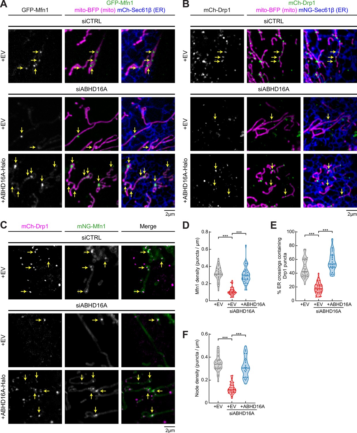 An ER phospholipid hydrolase drives ER-associated