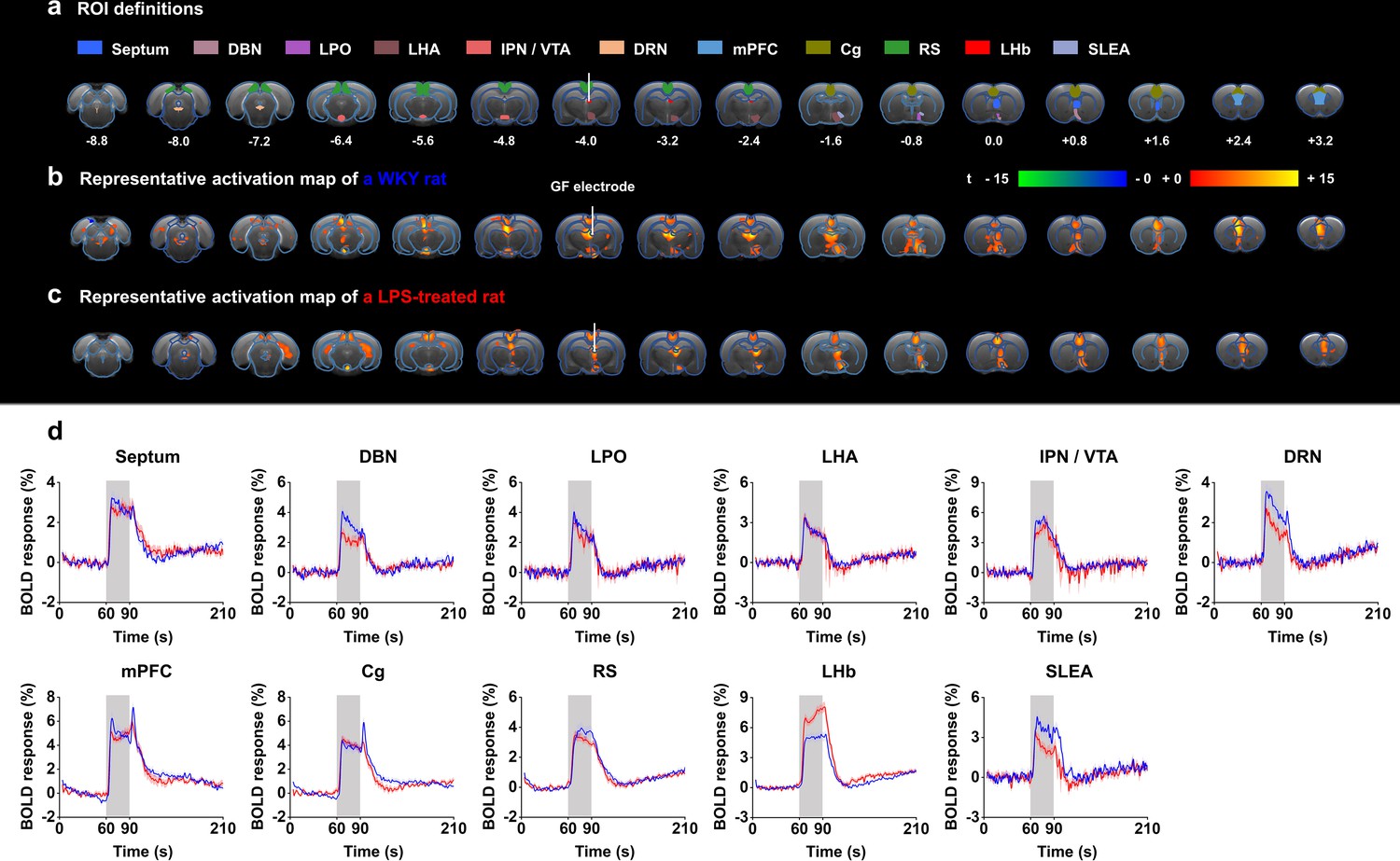 Instantaneous Antidepressant Effect Of Lateral Habenula Deep Brain ...