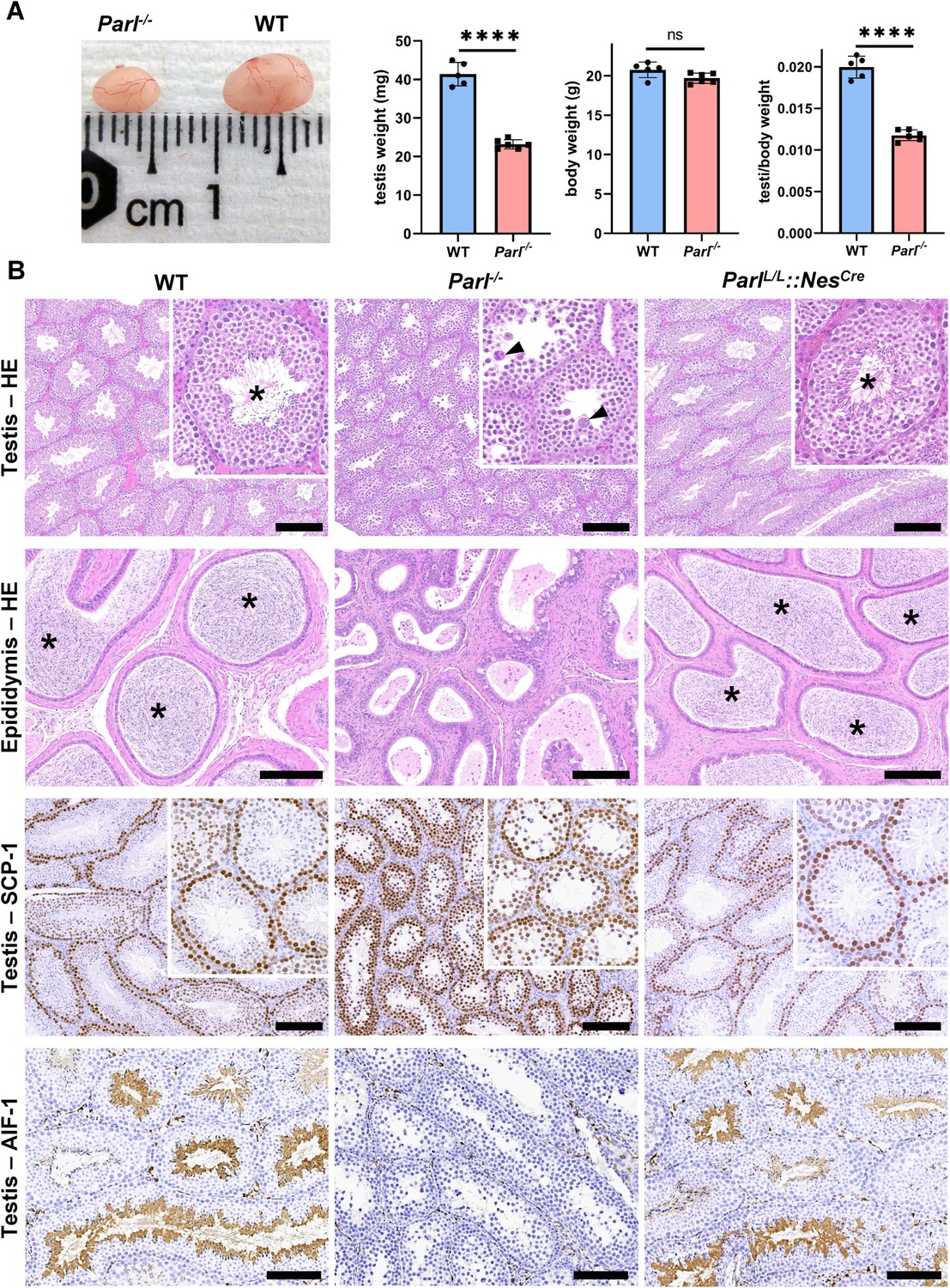 Mitochondrial defects caused by PARL deficiency lead to arrested  spermatogenesis and ferroptosis