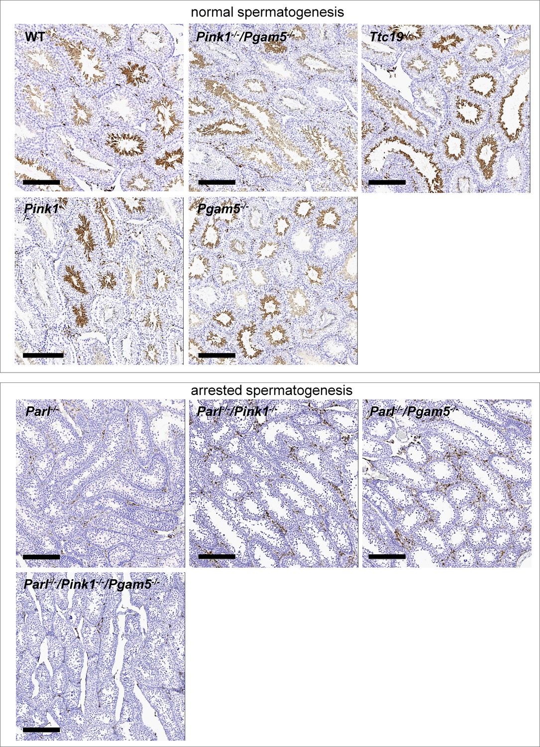 Mitochondrial defects caused by PARL deficiency lead to arrested  spermatogenesis and ferroptosis