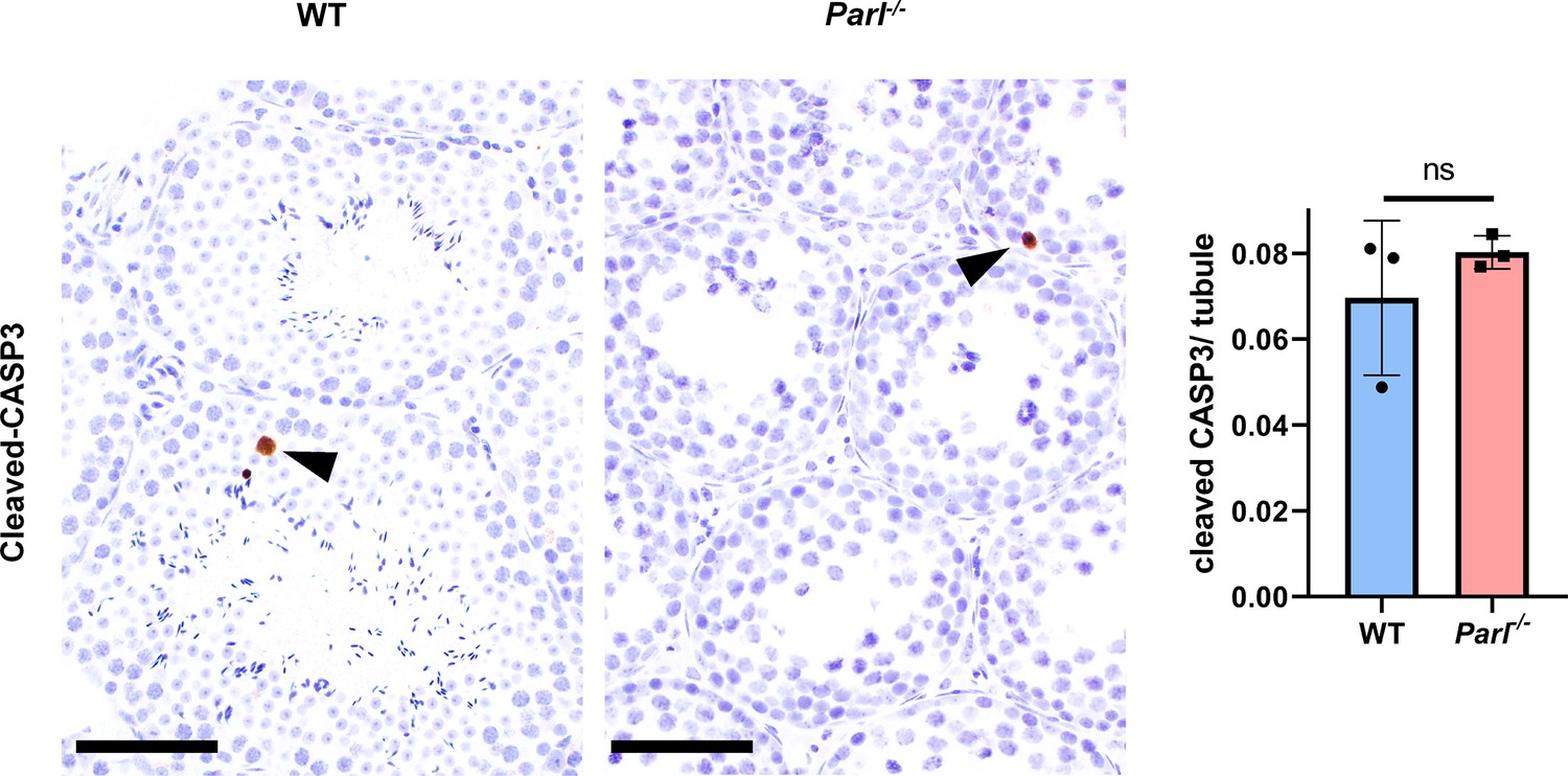 Mitochondrial defects caused by PARL deficiency lead to arrested  spermatogenesis and ferroptosis