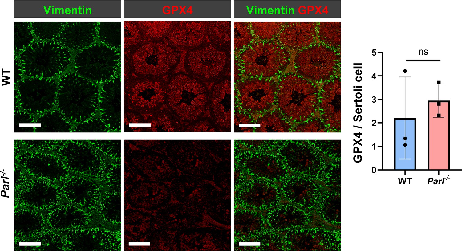 Mitochondrial defects caused by PARL deficiency lead to arrested  spermatogenesis and ferroptosis