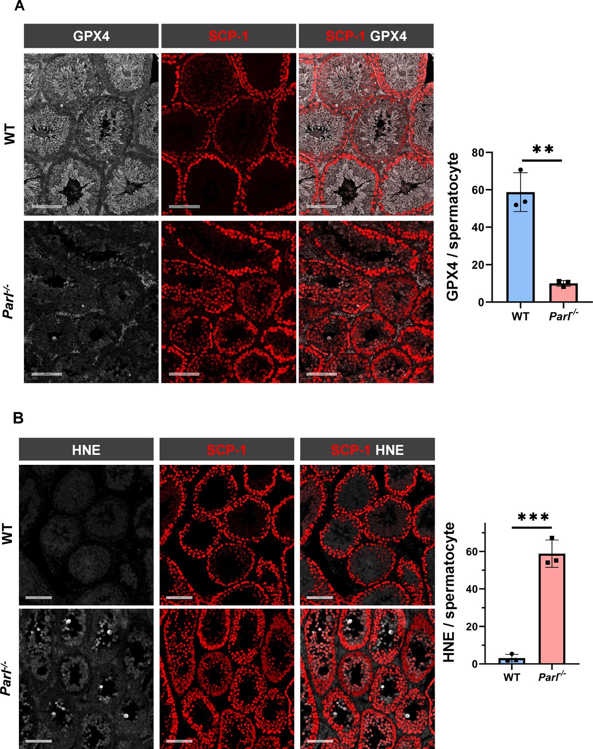 Mitochondrial defects caused by PARL deficiency lead to arrested  spermatogenesis and ferroptosis