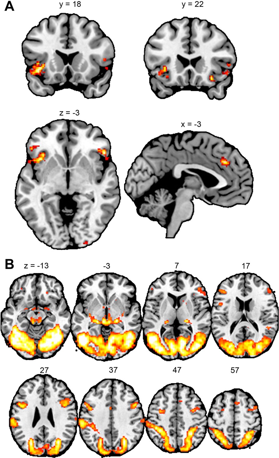 Neuroimaging and behavioral evidence that violent video games