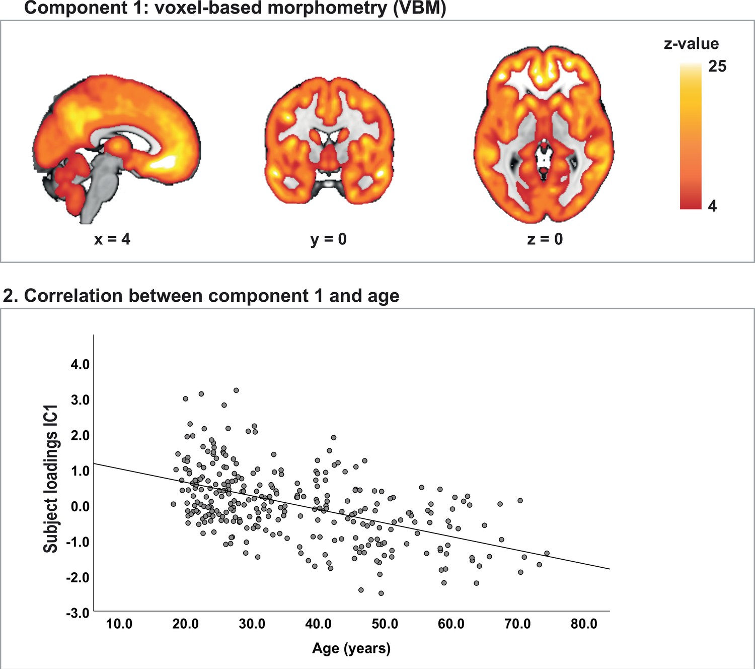 Bayesian causal network modeling suggests adolescent cannabis use  accelerates prefrontal cortical thinning