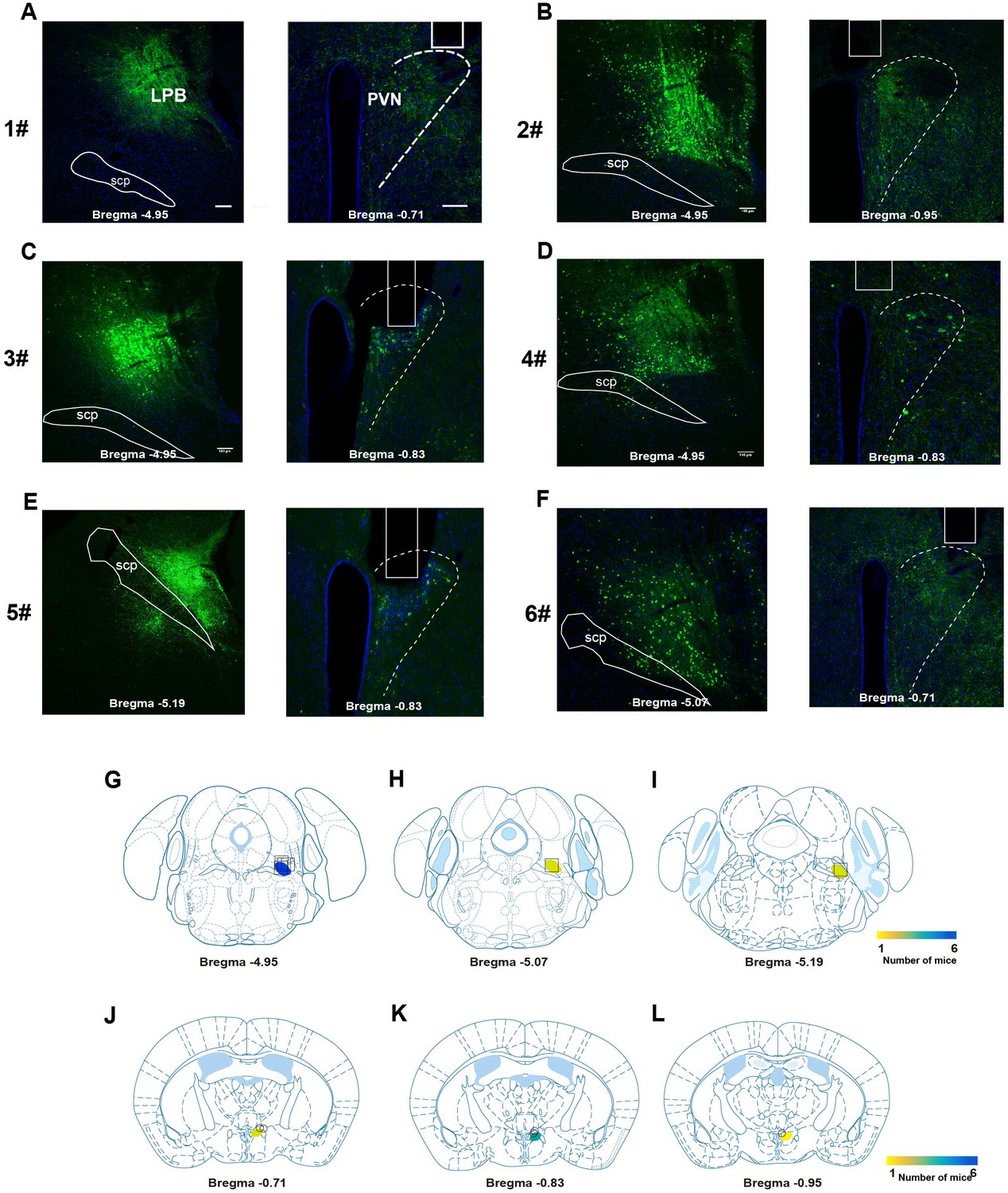 A parabrachial to hypothalamic pathway mediates defensive behavior