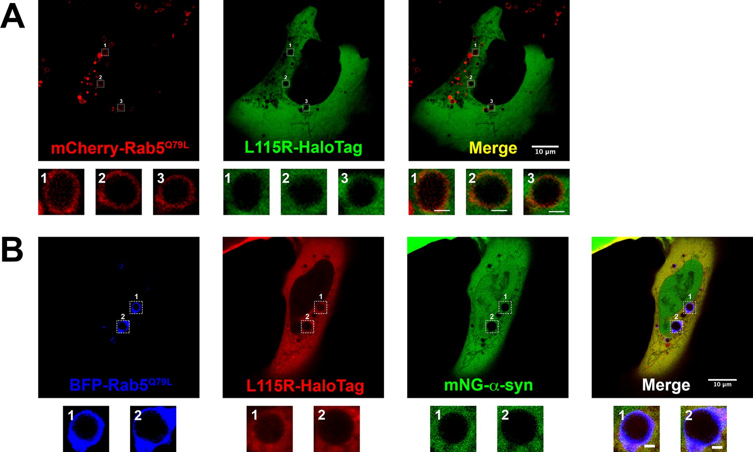 Figures And Data In Unconventional Secretion Of α-synuclein Mediated By ...